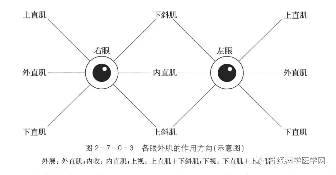 眼球运动障碍怎么训练_眼球运动障碍_眼球障碍运动能治好吗