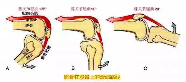 髌骨运动_运动髌骨带哪个牌子好_运动髌骨带有用吗