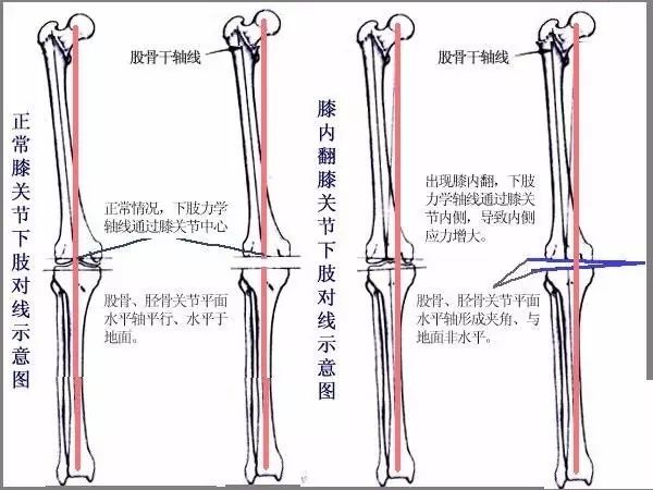 髌骨运动_运动髌骨损伤怎么办_运动髌骨带怎么用