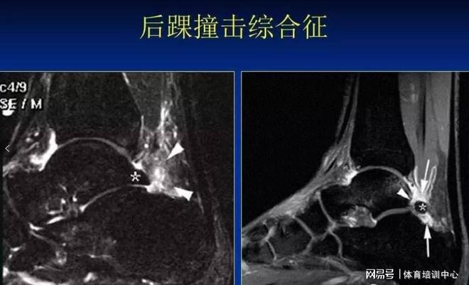 高薪运动_高薪运动排名_高薪运动员最简单三个指标
